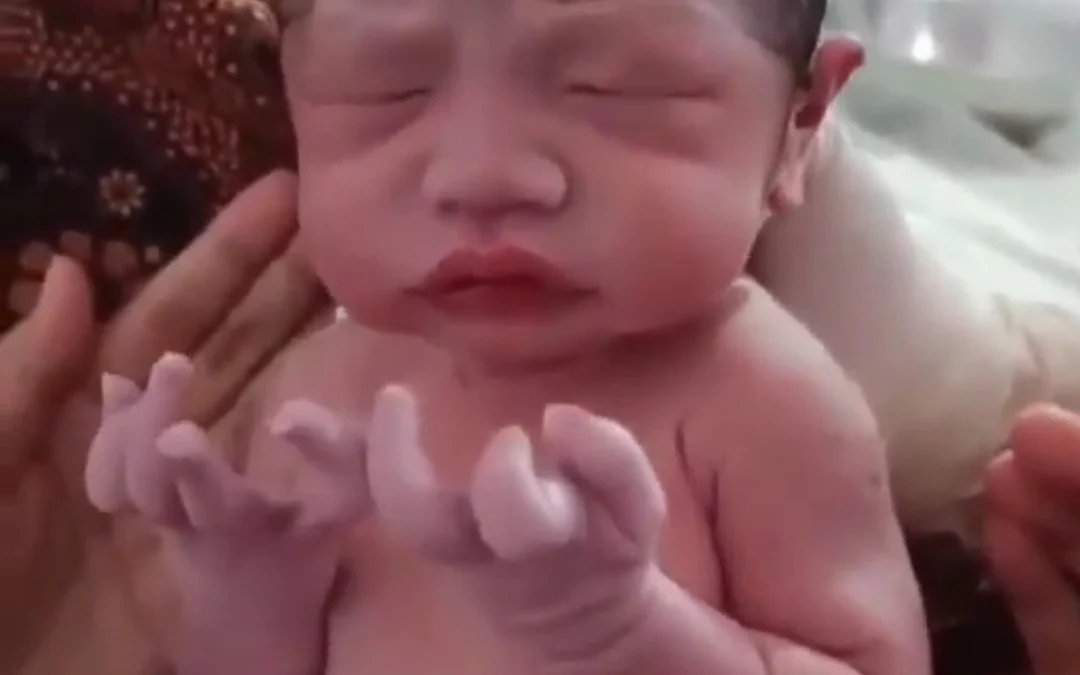 bayi lahir posisi tangan amin