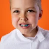 Cara Mencegah Gigi Berlubang untuk Anak-anak