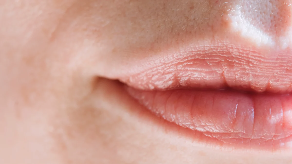 Bahaya Jilati Bibir yang Kering saat Puasa